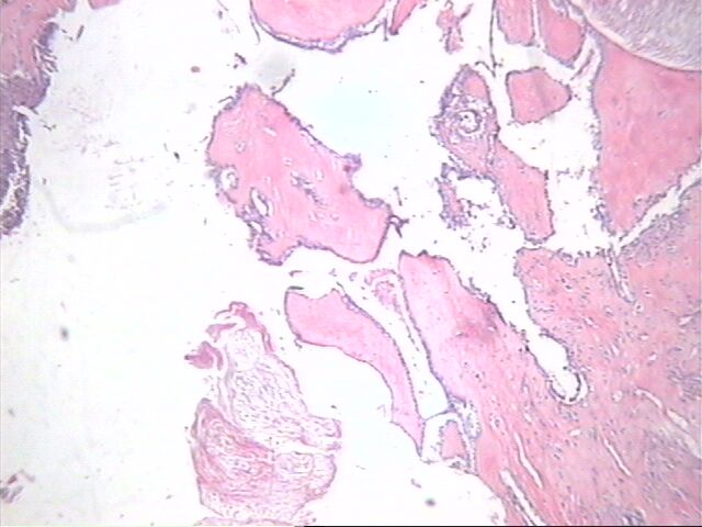 Fig. 6 Queratina,imgenes en hoja y hialinizacin. - <div style=